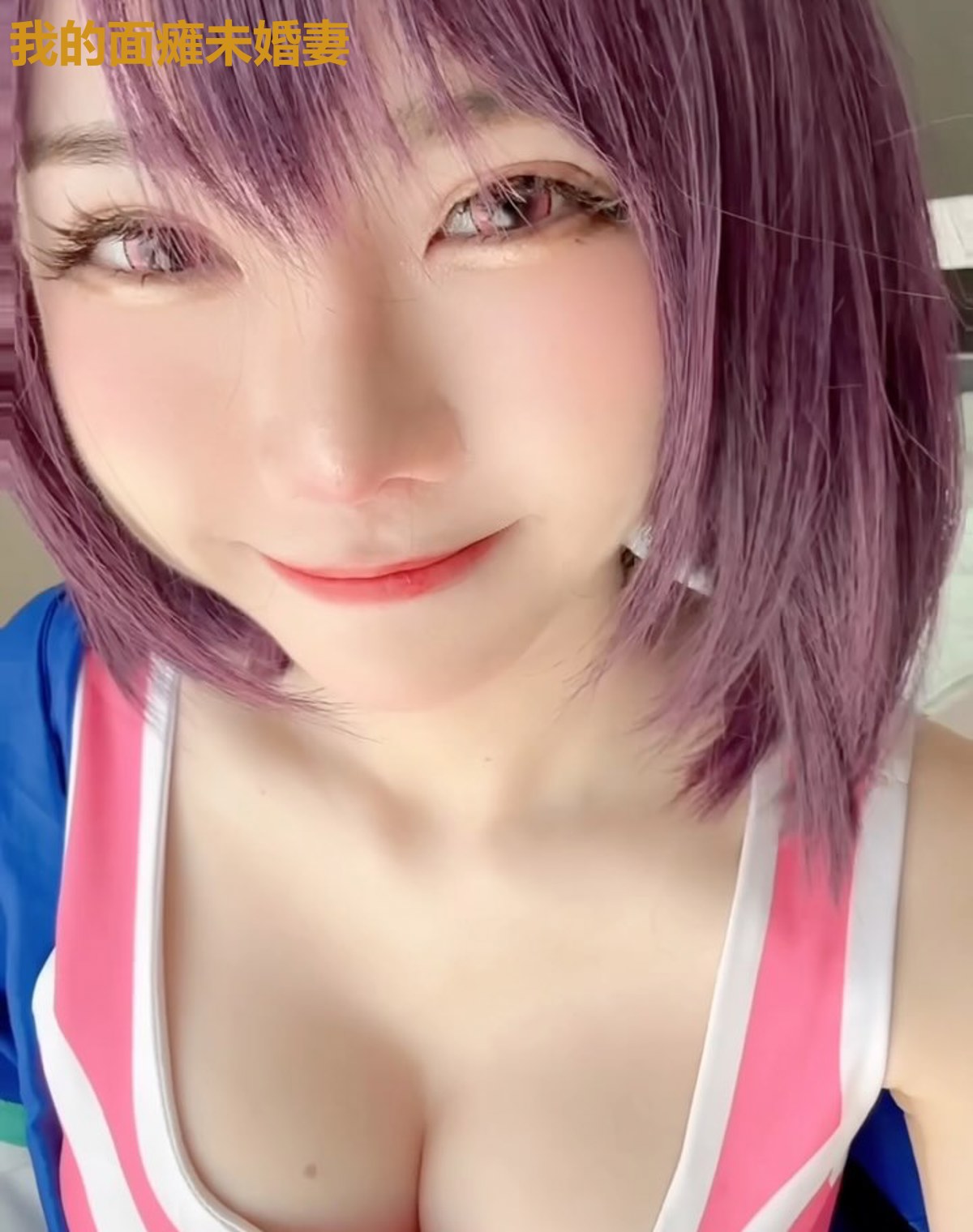 我的面瘫未婚妻
