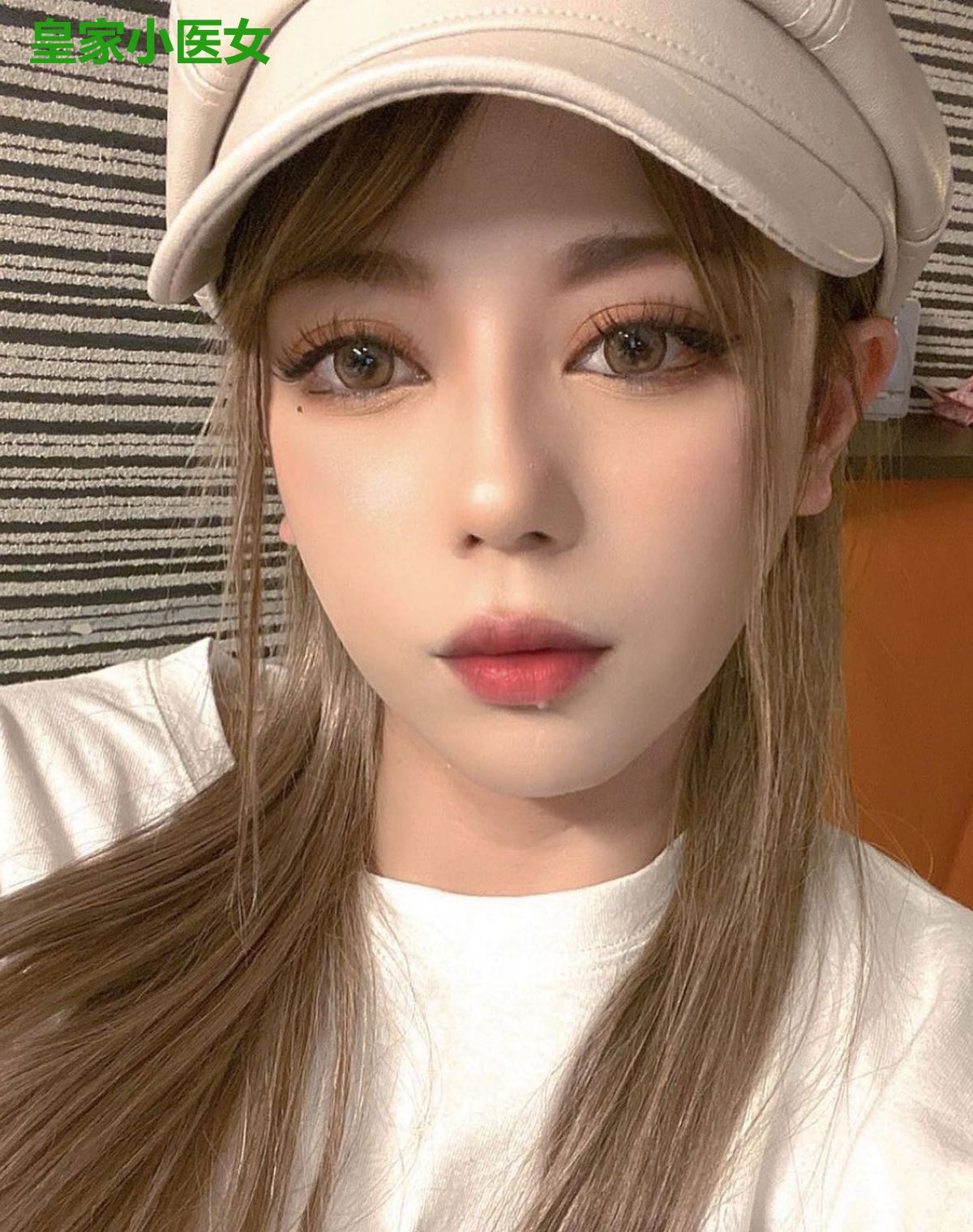 皇家小医女